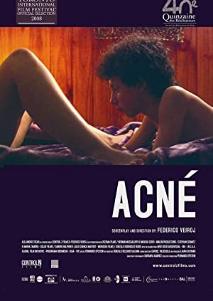 Acné (2008) with English Subtitles on DVD on DVD